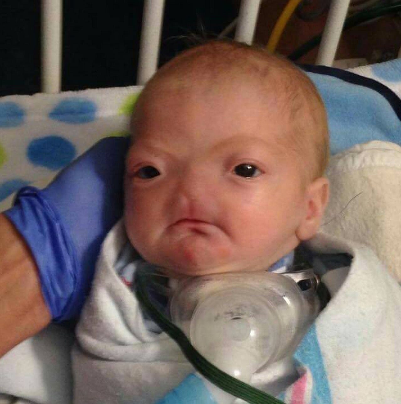 infant nose